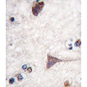 Serine/threonine-Protein Kinase B-Raf (BRAF) Antibody