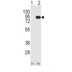 Serine/threonine-Protein Kinase B-Raf (BRAF) Antibody