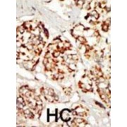 Kinase Suppressor of Ras 1 (KSR1) Antibody