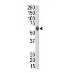 Kinase Suppressor of Ras 1 (KSR1) Antibody