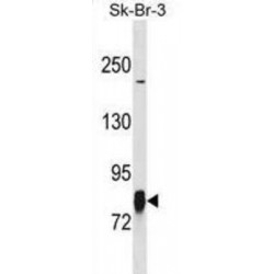 LIM Kinase 1 Antibody