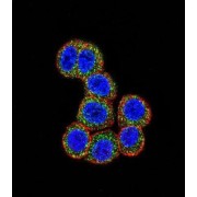 Raf Proto-Oncogene Serine/Threonine Protein Kinase (RAF1) Antibody
