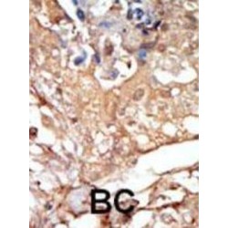Raf Proto-Oncogene Serine/Threonine Protein Kinase (RAF1) Antibody