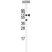 Cholinesterase (BCHE) Antibody