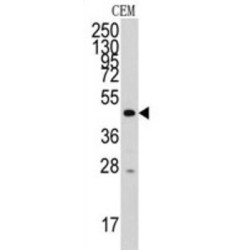 Tyrosine-tRNA Ligase, Mitochondrial (YARS2) Antibody