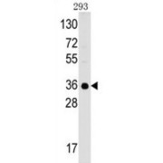 Complement C1q Binding Protein (C1QBP) Antibody