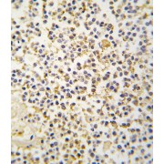 Aldehyde Dehydrogenase Family 1 Member A3 (ALDH1A3) Antibody