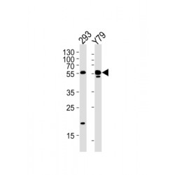 Aldehyde Dehydrogenase Family 1 Member A3 (ALDH1A3) Antibody