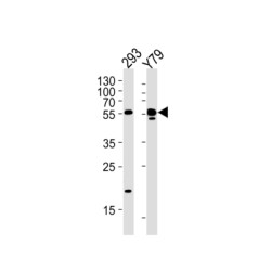 Aldehyde Dehydrogenase Family 1 Member A3 (ALDH1A3) Antibody