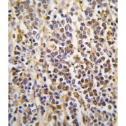 Aldehyde Dehydrogenase Family 1 Member A3 (ALDH1A3) Antibody