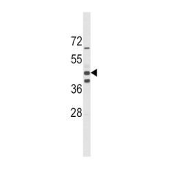 Aldehyde Dehydrogenase Family 1 Member A3 (ALDH1A3) Antibody