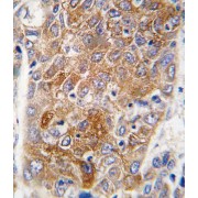 abx033714