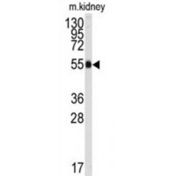 Aldehyde Dehydrogenase 9 Family, Member A1 (ALDH9A1) Antibody