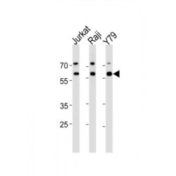 Acetylcholinesterase (AChE) Antibody
