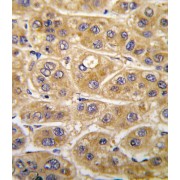 Angiotensinogen (AGT) Antibody