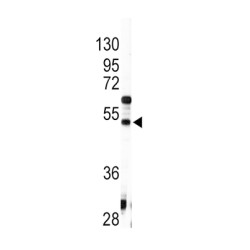 Angiotensinogen (AGT) Antibody