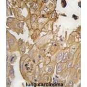 Glia Maturation Factor Gamma (GMFG) Antibody