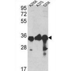 Glyceraldehyde-3-Phosphate Dehydrogenase (GAPDH) Antibody