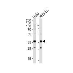 Glyceraldehyde-3-Phosphate Dehydrogenase (GAPDH) Antibody