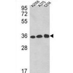 Glyceraldehyde-3-Phosphate Dehydrogenase (GAPDH) Antibody