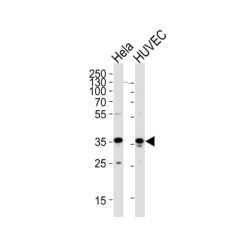 Glyceraldehyde-3-Phosphate Dehydrogenase (GAPDH) Antibody