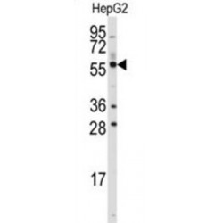 Aldehyde Dehydrogenase 4 Family, Member A1 (ALDH4A1) Antibody