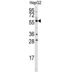 Aldehyde Dehydrogenase 4 Family, Member A1 (ALDH4A1) Antibody