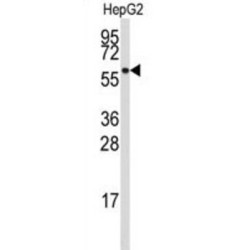 Aldehyde Dehydrogenase 4 Family, Member A1 (ALDH4A1) Antibody