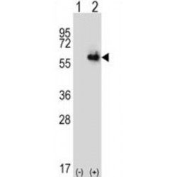 Aldehyde Dehydrogenase 4 Family, Member A1 (ALDH4A1) Antibody