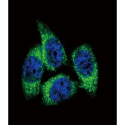 Steroid 17-Alpha-Hydroxylase/17,20 Lyase (CYP17A1) Antibody