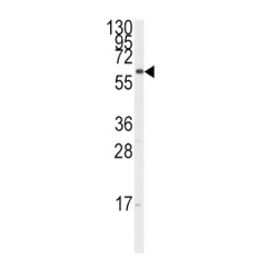 Steroid 17-Alpha-Hydroxylase/17,20 Lyase (CYP17A1) Antibody