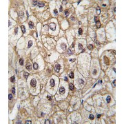 Cytochrome P450 2C9 (CYP2C9) Antibody