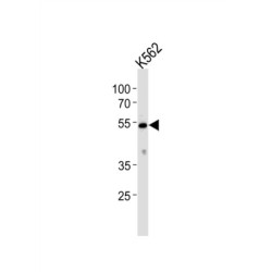 Cytochrome P450 Family 26 Subfamily C Member 1 (CYP26C1) Antibody
