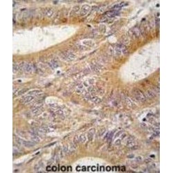 Aurora Kinase A (AURKA) Antibody