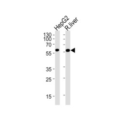 Hexokinase-4 (GCK) Antibody