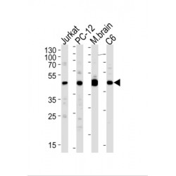 Dual Specificity Mitogen-Activated Protein Kinase Kinase 1 (MEK1) Antibody