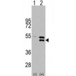 Dual Specificity Mitogen-Activated Protein Kinase Kinase 5 (MAP2K5) Antibody