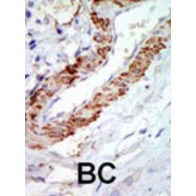 Proto-Oncogene C-Cot (COT) Antibody