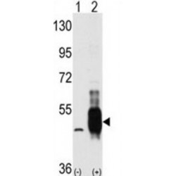 Proto-Oncogene C-Cot (COT) Antibody