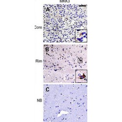 Dual Specificity Mitogen-Activated Protein Kinase Kinase 3 (MEK3) Antibody