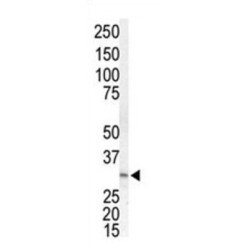 Dual Specificity Mitogen-Activated Protein Kinase Kinase 3 (MEK3) Antibody