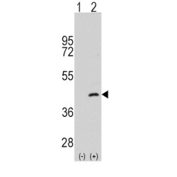 MAPK/ERK Kinase Kinase 4 (MEKK4) Antibody