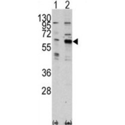 P21 (RAC1) Activated Kinase 3 (PAK3) Antibody