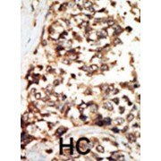 Protein Kinase D2 (PKD2) Antibody