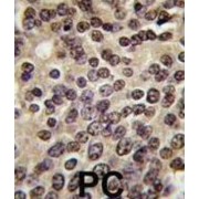 PKN beta Antibody
