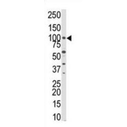 PKN beta Antibody