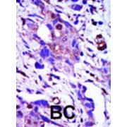 Serine/threonine-Protein Kinase PLK1 (PLK1) Antibody