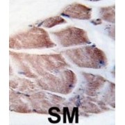 Ribosomal Protein S6 Kinase Alpha-3 (RPS6KA3) Antibody