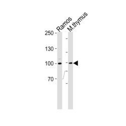 Ribosomal Protein S6 Kinase Alpha-3 (RPS6KA3) Antibody