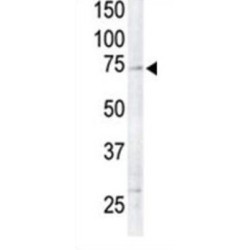 Ribosomal Protein S6 Kinase Alpha-6 (RPS6KA6) Antibody